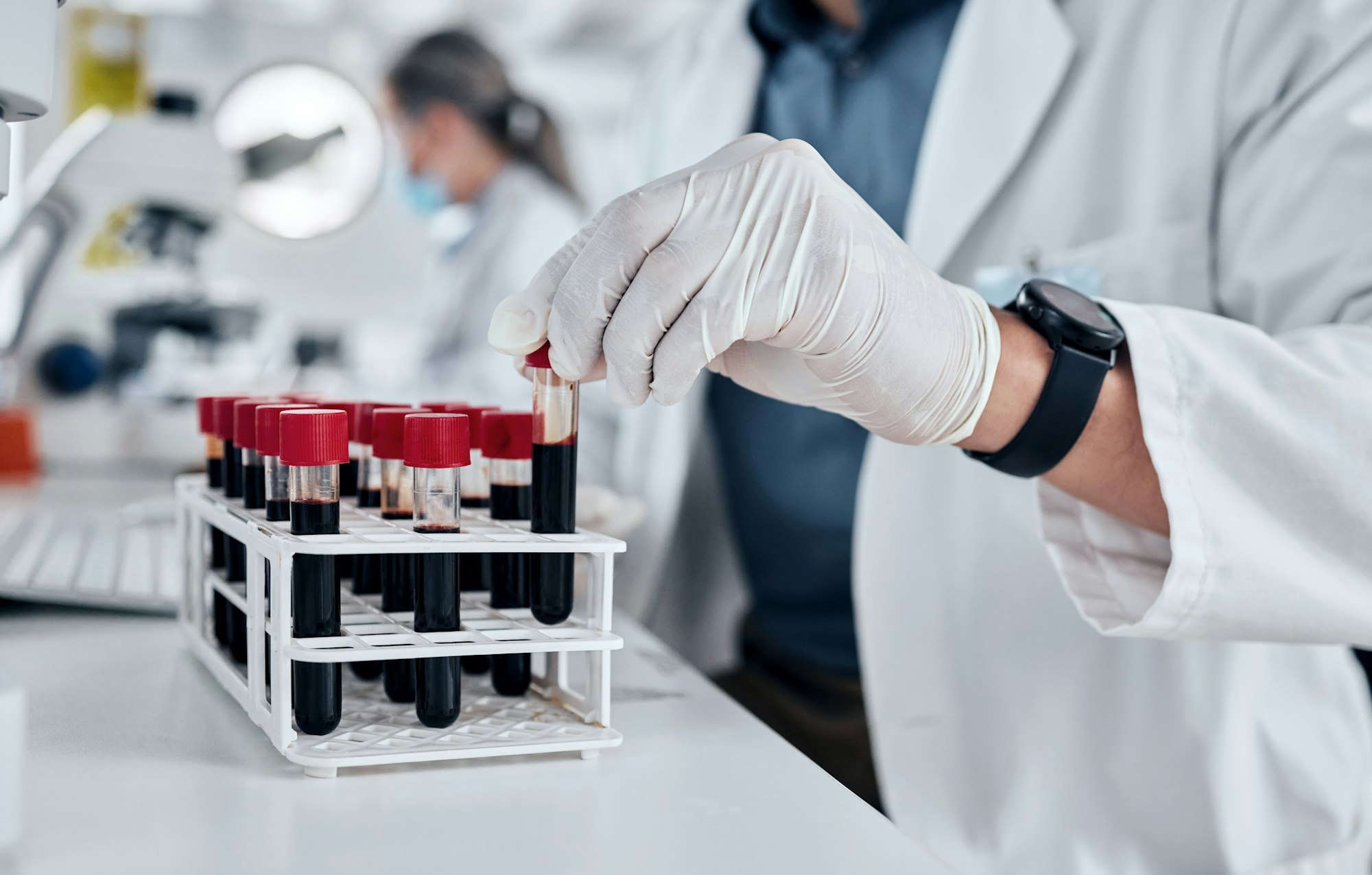 Scientist, science and dna blood sample test tube in pathology lab with gloves doing research and w